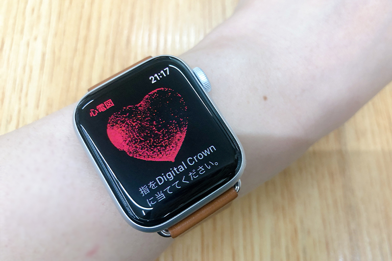 Apple watch